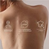 Bioderma - Nodé K - Kerato-reducerende Emulsie - 100ml - Voor Geïrriteerde Hoofdhuid