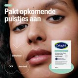 Cetaphil - Pimple Patch - 24 Stuks - Geschikt Voor Gevoelige Huid - Salicylzuur