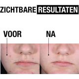 Neutrogena - Clear & Defend+ Peeling Serum - 30ml - Parfumvrij