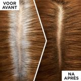 L'Oréal Paris Magic Retouch Goud Middenbruin Camouflerende Uitgroeispray Voordeelverpakking - 6 x 75ml