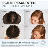 L'Oréal Paris - Elvive Fiber Booster - Conditioner - 150ml - Vermindert Haaruitval