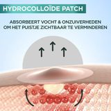 Garnier - Pure Active - Pimple Patch - Transparant - Vegan - 2 Formaten