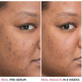 IT Cosmetics Bye Bye Dark Spots Niacinamide Serum 30 ml