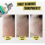 Kiehl's - Truly Targeted Blemish-Clearing Solution - Gezichtsverzorging - Salicylzuur