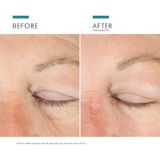 SkinCeuticals A.G.E. Advanced Eye voor Donkere Kringen en Rimpels 15ml