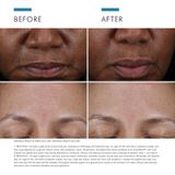 Gezichtsscrub - 30ml - Multi-Zurencomplex - Voor Alle Huidtypes