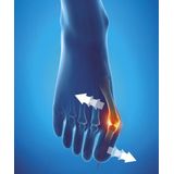 Epitact Hallux valgus corrigerende orthese maat 36/38 1 stuk