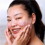 SVR - Sebiaclear - Gezichtsreiniger - Schuim - 400ml