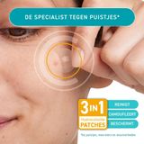 COMPEED® Anti-Spots* Cleansing - bij puistjes, mee-eters en onzuiverheden - pimple patch - 7st
