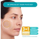 COMPEED® Anti-Spots* Cleansing - bij puistjes, mee-eters en onzuiverheden - pimple patch - 7st