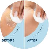 Scholl - Élimination des Callosités - Eeltverwijderaar - Wit - Elektrisch