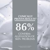 Eucerin - ULTRA SENSITIVE - Gezichtscrème - Hydraterend - Voor Normale tot Gecombineerde Huid