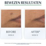 Eucerin Dermopure Triple Action Serum