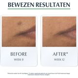 Eucerin - DermoPure Beschermende Dagcreme Fluid - SPF 30 - 50 ml