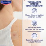 Hansaplast Littekenvervager - 1 Stuk