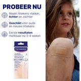 Hansaplast - Littekenvervager - Transparant - Polyurethaan - 24 Patches