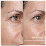 Babor - Doctor Power Serum Ampoules - 7 x 2 ml - Peptides