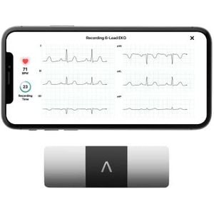 Omron AliveCor KardiaMobile ECG Mobiel 6 L