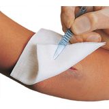 Vliwasoft - Vlieskompres - 10 x 10 cm - 4-laags - Sterk Absorberend