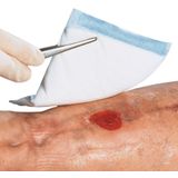 Gaaskompres - Licht Blauw - 100% Polypropyleenvezelstof - Voor Geïnfecteerde Wonden