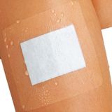 Lohmann & Rauscher - Curapor - Wondverband - Transparant - Waterdicht en luchtdoorlatend