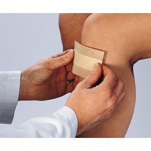 Curaplast Wondpleister sensitive 8 cm x 10 cm 10st