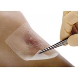 Cuticell Class 10X10 72538 Bsn