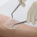 Leukoplast - Cuticell Classic - Kompres - Paraffine - Latex-vrij