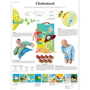 3B Scientific Anatomie humaine - Tableau cholestérol, version plastifiée