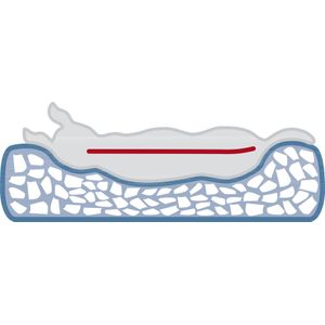 Trixie Vital - Hondenkussen Bendson - Orthopedisch - Grijs - 100X70 cm