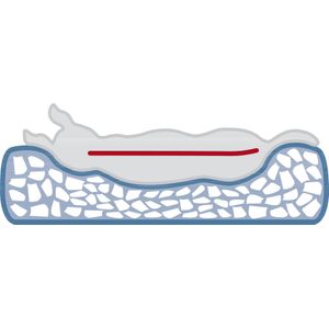 Trixie - Vital Hondenkussen Bendson Orthopedisch Grijs - 120 X 80 CM