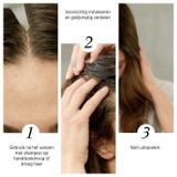 System Professional - Nativ Scalp Fluid - Haarserum - Natuurlijke Ingrediënten - Vrij van Parabenen en Siliconen