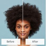 Nioxin - Scalp Relief Conditioner - Aloë Vera - Hydraterend - 300 ml