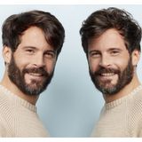 Nioxin System 1 Scalp & Hair Treatment 100 ml