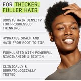 Nioxin - System 2 - Conditioner - 300ml - Vermindert haaruitval door breuk tot 91%