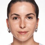 Catrice - Allround Corrector Palette - Concealer - 6 g