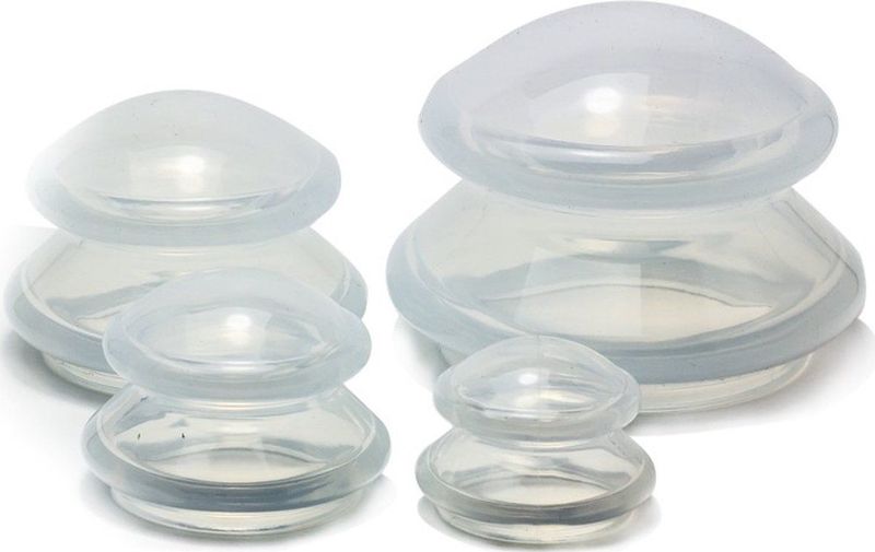 Cupping set siliconen 4-delig