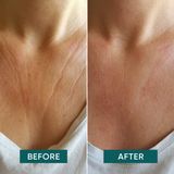 Decolletékussen - Vitamine C - 30 Pads - Huidvriendelijke Siliconen