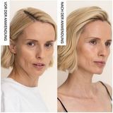 Lichttherapie - Professionele Therapie - Rood en Nabij-Infrarood - Veilig en Pijnloos