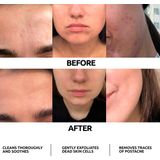 Marie Fresh - Foam Cleaner - Gezichtsverzorging - Natuurlijk - 160 ml