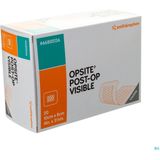 OPSITE Post-OP Visible - Pleister - Transparant - 8 x 10 cm - 20 Stuks