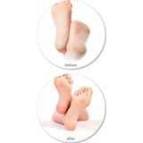 Rio - 60 Seconden Pedi - Eeltverwijderaar - Wit - Inclusief Vervangbare Kop