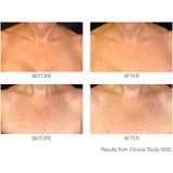 Rio  Decolite - Nek & Decolleté beauty boosting LED light treatment