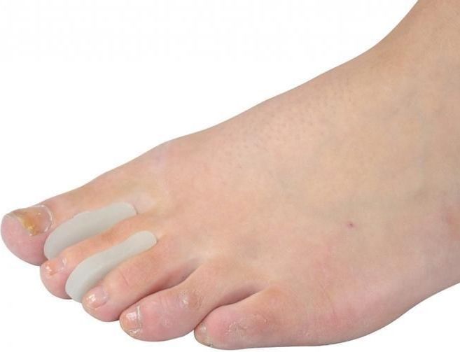 Teenspreiders - Dun - Verpakt per 2 Stuks