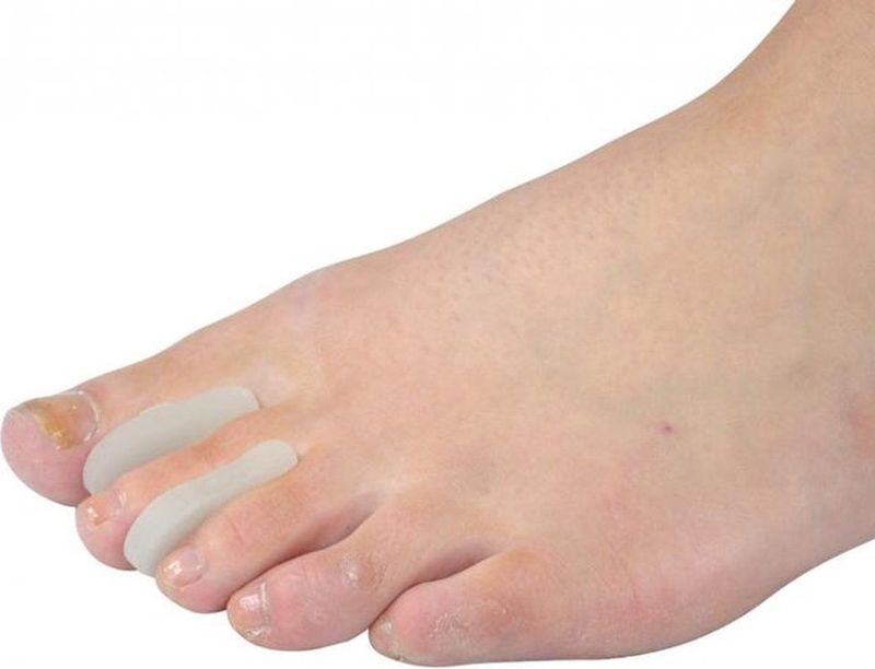 Teenspreiders - Dun - Medium/Large - Verpakt per 2 Stuks