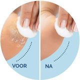 Scholl - Velvet Smooth - Elektrische Voetvijl - Eeltverwijderaar - Draadloos