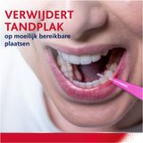 Parodontax Interdentale Ragers 0,4 mm – Maat 0 | 6 stuks