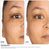 Vitamine C Concentrraat - 15% - Lichtgewicht Formule - Verheldert Teint