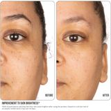 Vitamine C Concentrraat - 15% - Lichtgewicht Formule - Verheldert Teint