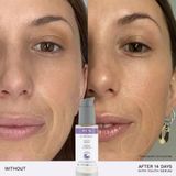 REN Clean Skincare - Bio Retinoid Youth Serum - Gezichtscreme - Dermatologisch Getest